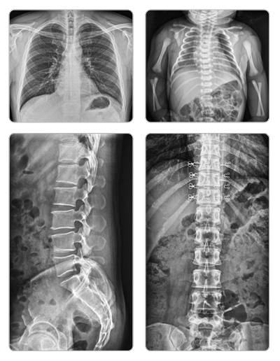 Mobile X-ray ภาพที่ 11
