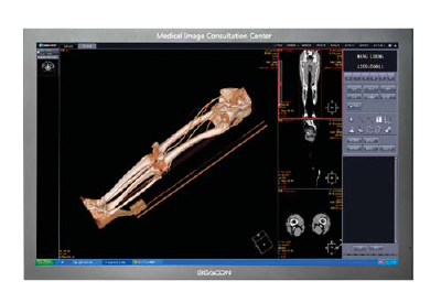 Medical Display ภาพที่ 11