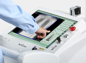 Mobile X-ray ภาพที่ 7