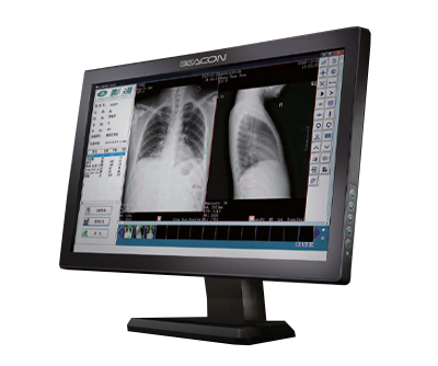Medical Display